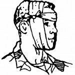 Figure 5-9. Tails tied in a non-slip knot and ends tucked (wound on cheek).