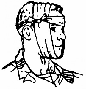 Figure 5-9. Tails tied in a non-slip knot and ends tucked (wound on cheek).
