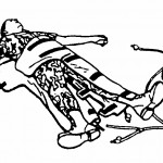 Figure 7-4. Wrapping the MAST around the casualty's leg.