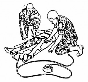 Figure 7-5. Securing one leg of the MAST.