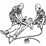 Figure 7-6. Securing the abdominal section of the MAST.