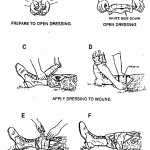 Figure 2-8. Applying and securing a field dressing to a wound on a leg.