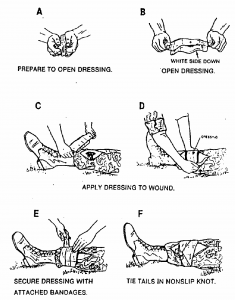 Figure 2-8. Applying and securing a field dressing to a wound on a leg.