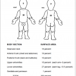 Figure 6-4. Rule of nines for a small child.