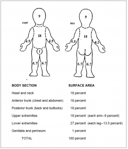Figure 6-4. Rule of nines for a small child.