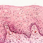 Microscopic view of skin (squamous epithelium)