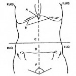 Figure 2-1. Quadrants of the abdomen.