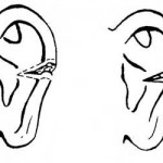 Figure 4-5. Laceration/natural healing of the ear.