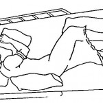 Figure 2-5. Lateral recumbent.