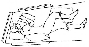 Figure 2-5. Lateral recumbent.