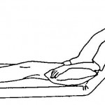 Figure 2-6. Fowler's position.