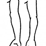 Figure 2-14. Range-of-motion exercises motion exercises for the forearm.