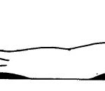 Figure 2-25. Positioning an injured leg.