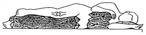 Figure 2-26. Leg and arm supported in abduction.