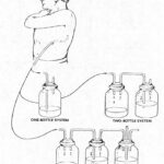 Figure 2-2. Water-seal drainage system
