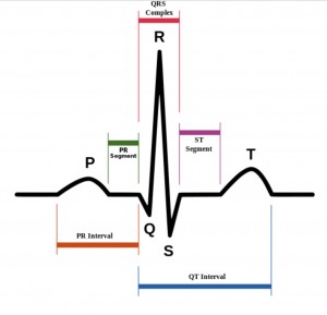 Schematic diagram of normal sinus rhythm for a human heart as seen on ECG