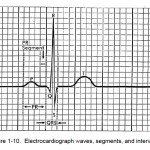 Figure 1-10. Electrocardiograph waves, segments, and intervals