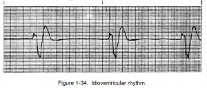 Figure 1-34. Idioventricular rhythm.
