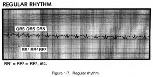 Figure 1-7. Regular rhythm