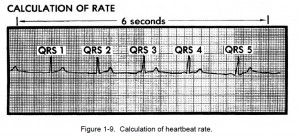 Figure 1-9. Calculation of heartbeat rate