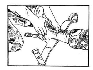 Figure 3-1. Positioning the ankle hitch of a Hare splint.