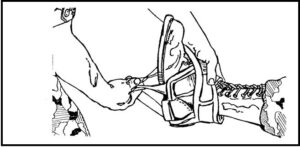 Figure 3-2. Ankle hitch applied to the casualty.