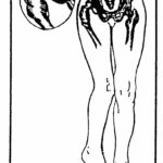Figure 4-2. Posterior dislocation of the hip.