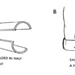 Figure 5-4. Immobilizing a forearm using a SAM splint.