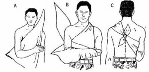 Figure 5-9. Applying a triangular bandage sling (arm sling number two).