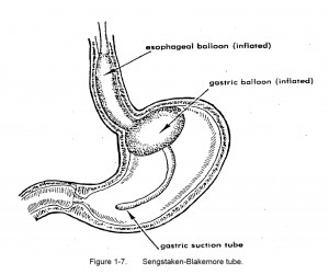 Figure 1-7. Sengstaken-Blakemore tube.