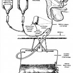 Figure 2-4. Continuous bladder irrigation