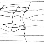 Figure 2-2. Patient in prone position for intramuscular injection in the buttocks.