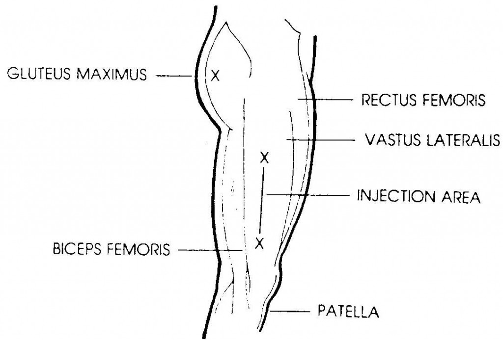 2.03 PROCEDURE FOR ADMINISTERING AN INTRAMUSCULAR INJECTION ...