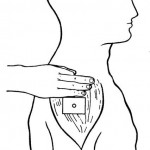 Figure 2-4. Location for upper arm injection.