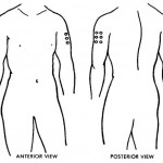 Figure 2-8. Deltoid area of shoulder, outer aspect of upper arm.