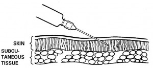 Figure 2-11. Position of needle. Proper angle and depth for an intradermal (ID) injection.