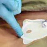 Figure 1-16. Palpating the sternal notch