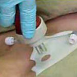 Figure 1-18. Proper alignment