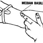 Figure 2-4. Palpating the vein