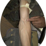 Arm showing veins