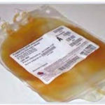 Plasma