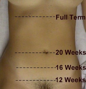 Approximate size of uterus at different gestational ages.