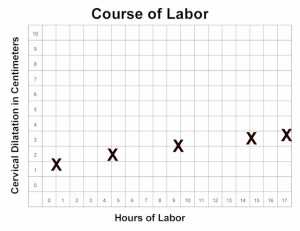 Prolonged Latent Phase of Labor