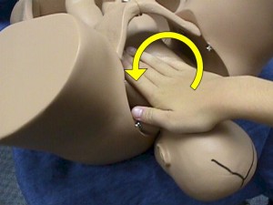 Unscrewing the fetal shoulder