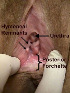 Hymen and Urethra