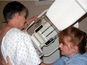 Screening mammogram