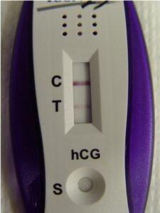 After 3 drops of urine are placed in the "S" basin, a sold line appears at the "C" area. After a minute, another line appears at the "T" area, indicating that this patient is pregnant.