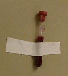 Red-topped tube taped to the wall
