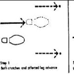 Figure 1-9. 3-point crutch walking gait.