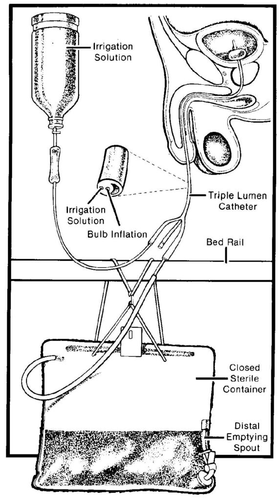 Lesson 3. Catheterization of the Male and Female Patient - Nursing ...